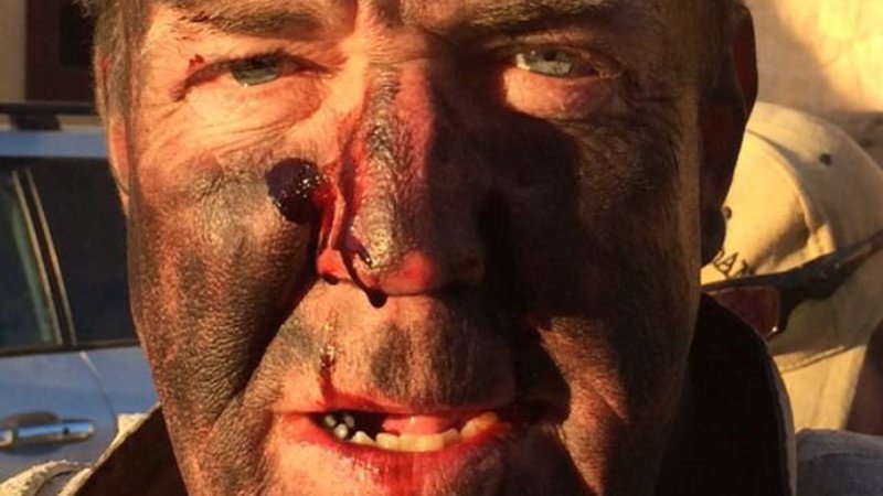 Jeremy Clarkson Tweets Bloody Selfie, Offers No Explanation